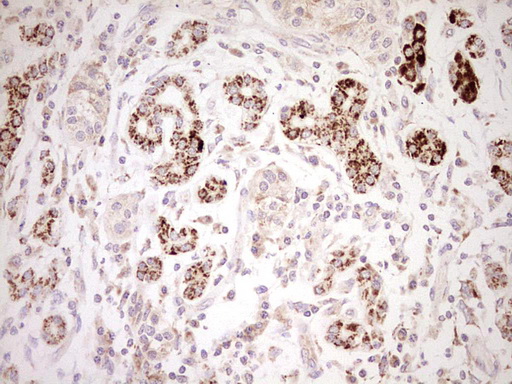 NR0B2 Antibody - Immunohistochemical staining of paraffin-embedded Carcinoma of Human pancreas tissue using anti-NR0B2 mouse monoclonal antibody. (Heat-induced epitope retrieval by Tris-EDTA, pH8.0) Dilution: 1:150