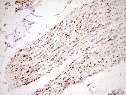 NR0B2 Antibody - Immunohistochemical staining of paraffin-embedded Human bladder tissue within the normal limits using anti-NR0B2 mouse monoclonal antibody. (Heat-induced epitope retrieval by Tris-EDTA, pH8.0) Dilution: 1:150