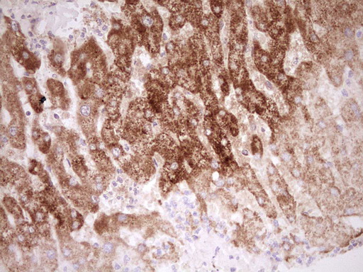 NR0B2 Antibody - Immunohistochemical staining of paraffin-embedded Human liver tissue within the normal limits using anti-NR0B2 mouse monoclonal antibody. (Heat-induced epitope retrieval by Tris-EDTA, pH8.0) Dilution: 1:150