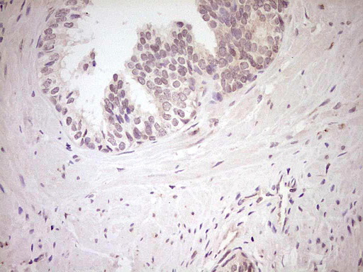 NR0B2 Antibody - Immunohistochemical staining of paraffin-embedded Human prostate tissue within the normal limits using anti-NR0B2 mouse monoclonal antibody. (Heat-induced epitope retrieval by Tris-EDTA, pH8.0) Dilution: 1:150