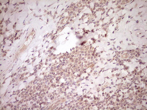 NR0B2 Antibody - Immunohistochemical staining of paraffin-embedded Human tonsil within the normal limits using anti-NR0B2 mouse monoclonal antibody. (Heat-induced epitope retrieval by Tris-EDTA, pH8.0) Dilution: 1:150