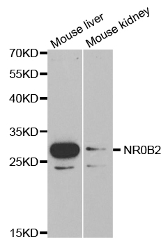 NR0B2 Antibody - Western blot analysis of extracts of various cell lines, using NR0B2 antibody.