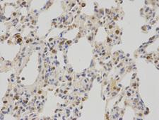 NR0B2 Antibody - Immunohistochemistry of paraffin-embedded rat lung using NR0B2 antibody at dilution of 1:100 (400x lens).