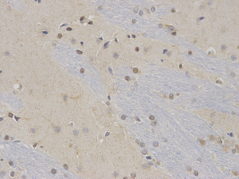 NR0B2 Antibody - Immunohistochemistry of paraffin-embedded rat brain using NR0B2 antibody at dilution of 1:100 (400x lens).