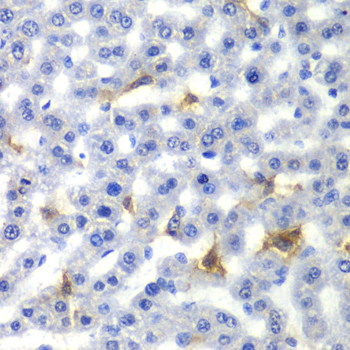 NR0B2 Antibody - Immunohistochemistry of paraffin-embedded rat liver tissue.