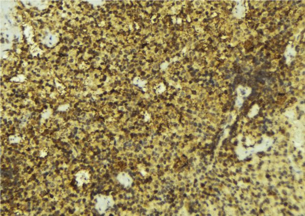 NR0B2 Antibody - 1:100 staining mouse pancreas tissue by IHC-P. The sample was formaldehyde fixed and a heat mediated antigen retrieval step in citrate buffer was performed. The sample was then blocked and incubated with the antibody for 1.5 hours at 22°C. An HRP conjugated goat anti-rabbit antibody was used as the secondary.