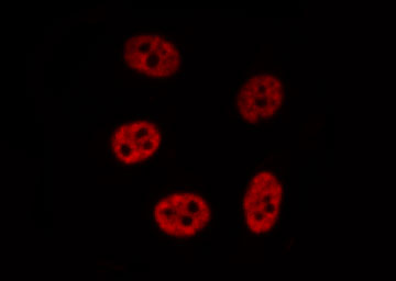 NR0B2 Antibody - Staining HepG2 cells by IF/ICC. The samples were fixed with PFA and permeabilized in 0.1% Triton X-100, then blocked in 10% serum for 45 min at 25°C. The primary antibody was diluted at 1:200 and incubated with the sample for 1 hour at 37°C. An Alexa Fluor 594 conjugated goat anti-rabbit IgG (H+L) antibody, diluted at 1/600, was used as secondary antibody.