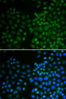 NR0B2 Antibody - Immunofluorescence analysis of U2OS cells using NR0B2 Polyclonal Antibody.