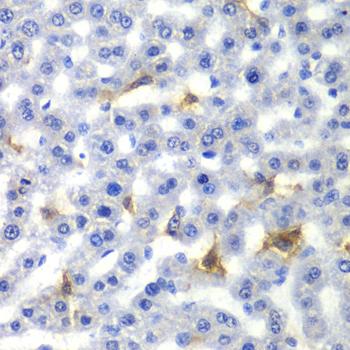 NR0B2 Antibody - Immunohistochemistry of paraffin-embedded Rat liver using NR0B2 Polyclonal Antibody at dilution of 1:100 (40x lens).