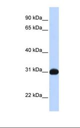 NR0B2 Antibody - Transfected 293T cell lysate. Antibody concentration: 1.0 ug/ml. Gel concentration: 12%.  This image was taken for the unconjugated form of this product. Other forms have not been tested.