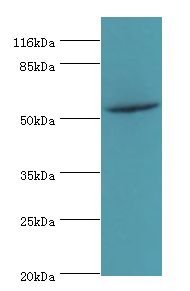 NR1A2 / THRB Antibody - Western blot. All lanes: THRB antibody at 2 ug/ml+mouse liver tissue. Secondary antibody: goat polyclonal to rabbit at 1:10000 dilution. Predicted band size: 53 kDa. Observed band size: 53 kDa.  This image was taken for the unconjugated form of this product. Other forms have not been tested.