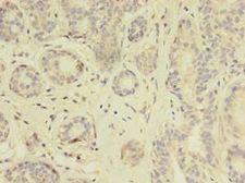 NR1A2 / THRB Antibody - Immunohistochemistry of paraffin-embedded human thyroid tissue using antibody at 1:100 dilution.  This image was taken for the unconjugated form of this product. Other forms have not been tested.