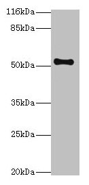 NR1A2 / THRB Antibody - Western blot All lanes: THRB antibody at 2µg/ml + Mouse liver tissue Secondary Goat polyclonal to rabbit IgG at 1/10000 dilution Predicted band size: 53, 55 kDa Observed band size: 53 kDa