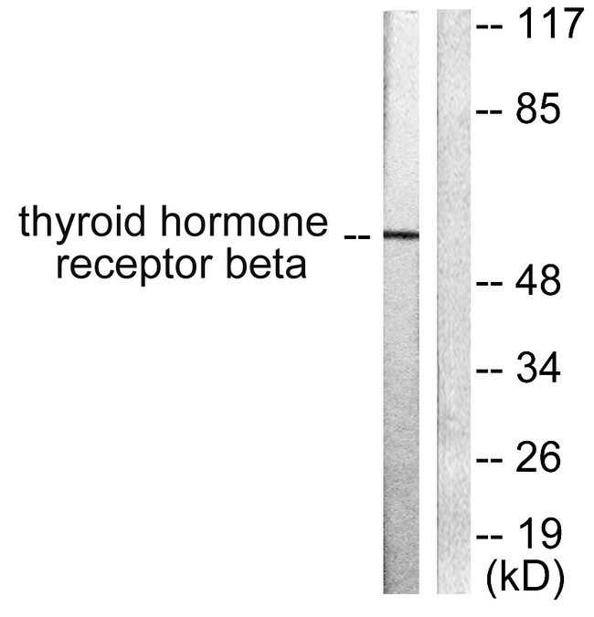 NR1A2 / THRB Antibody - Western blot analysis of lysates from LOVO cells, using Thyroid Hormone Receptor beta Antibody. The lane on the right is blocked with the synthesized peptide.