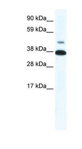 NR1A2 / THRB Antibody - THRB antibody Western blot of Fetal skeletal muscle lysate. This image was taken for the unconjugated form of this product. Other forms have not been tested.