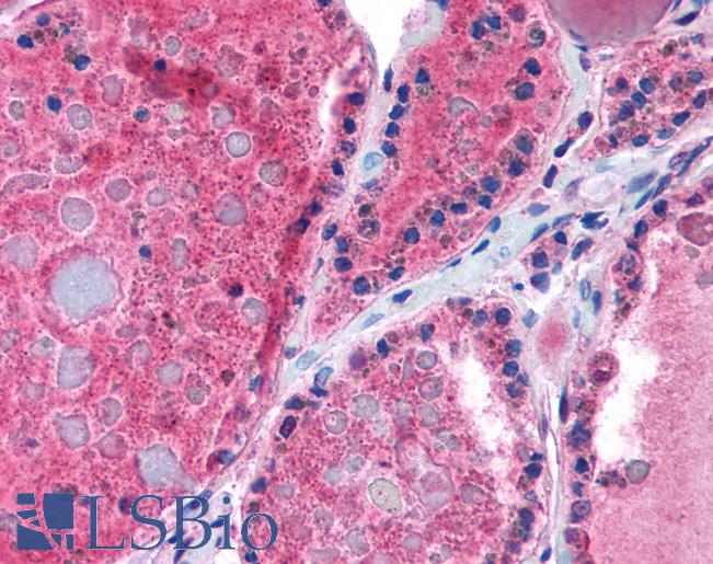 NR1A2 / THRB Antibody - Anti-THRB antibody IHC of human thyroid. Immunohistochemistry of formalin-fixed, paraffin-embedded tissue after heat-induced antigen retrieval. Antibody concentration 5 ug/ml.  This image was taken for the unconjugated form of this product. Other forms have not been tested.