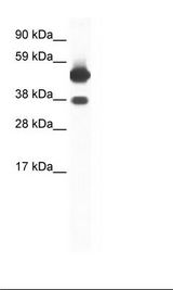 NR1A2 / THRB Antibody - Fetal Skeletal Muscle Lysate.  This image was taken for the unconjugated form of this product. Other forms have not been tested.