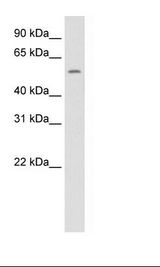NR1A2 / THRB Antibody - SP2/0 Cell Lysate.  This image was taken for the unconjugated form of this product. Other forms have not been tested.