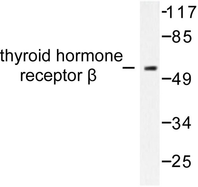 NR1A2 / THRB Antibody - Western blot of Thyroid Hormone Receptor (L37) pAb in extracts from LOVO cells.