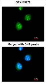 NR1A2 / THRB Antibody - Immunofluorescence of paraformaldehyde-fixed HeLa, using Thyroid Hormone Receptor beta antibody at 1:200 dilution.