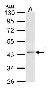 NR1A2 / THRB Antibody - Sample (30 ug of whole cell lysate). A: Hep G2. 10% SDS PAGE. THRB antibody diluted at 1:1000. 