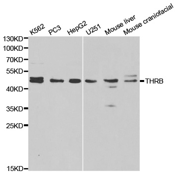 NR1A2 / THRB Antibody - Western blot analysis of extracts of various cell lines, using THRB antibody.