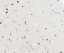 NR1A2 / THRB Antibody - 1:100 staining human brain tissue by IHC-P. The tissue was formaldehyde fixed and a heat mediated antigen retrieval step in citrate buffer was performed. The tissue was then blocked and incubated with the antibody for 1.5 hours at 22°C. An HRP conjugated goat anti-rabbit antibody was used as the secondary.