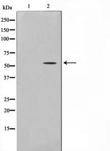 NR1A2 / THRB Antibody - Western blot analysis on 293 cell lysates using THR1 antibody