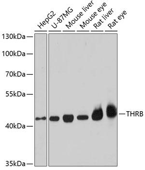 NR1A2 / THRB Antibody - Western blot analysis of extracts of various cell lines using THRB Polyclonal Antibody at dilution of 1:1000.