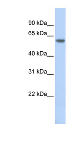 NR1A2 / THRB Antibody - THRB antibody Western blot of Fetal Brain lysate. This image was taken for the unconjugated form of this product. Other forms have not been tested.