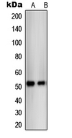 NR1A2 / THRB Antibody - Western blot analysis of THRB expression in SKBR3 (A); C32 (B) whole cell lysates.