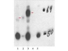 NR1A2 / THRB Antibody - Anti-THRB1 Antibody - Western Blot. Western blot of affinity purified anti-THRB1 antibody shows detection of in vitro translated THRB1 (lane 2) and human thyroid stable cell line expressing THTRb1 (lane 3). No staining is evident in non transfected human thyroid cells (lane 1), over expressed THRA (lane 4) or HeLa stable cell line expressing THRA1 (lane 5). The band at ~62 kD, indicated by the arrowheads, corresponds to THRB. Personal communication, H. Ying, NCI, Bethesda, MD.