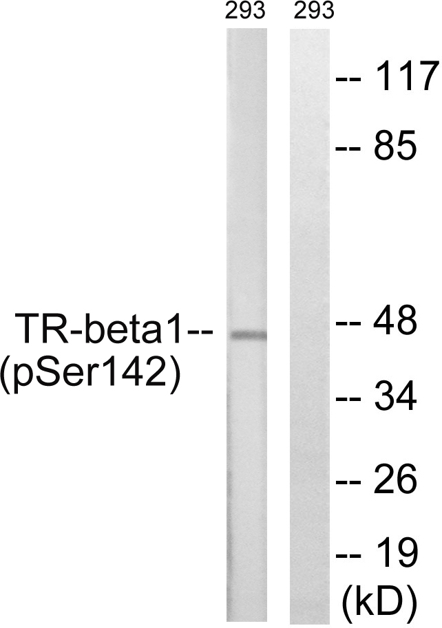 NR1A2 / THRB Antibody - Western blot analysis of lysates from 293 cells treated with PMA 125ng/ml 30', using TR-beta1 (Phospho-Ser142) Antibody. The lane on the right is blocked with the phospho peptide.