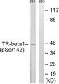 NR1A2 / THRB Antibody - Western blot analysis of extracts from 293 cells, treated with PMA (125ng/ml, 30mins), using TR-ß1 (Phospho-Ser142) antibody.