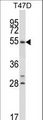 NR1D1 Antibody - NR1D1 Antibody western blot of T47D cell line lysates (35 ug/lane). The NR1D1 antibody detected the NR1D1 protein (arrow).