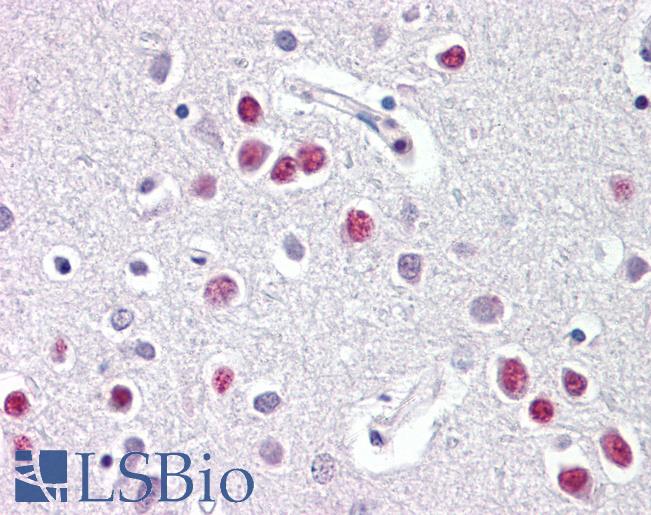NR1D1 Antibody - Anti-NR1D1 antibody IHC of human brain, cortex. Immunohistochemistry of formalin-fixed, paraffin-embedded tissue after heat-induced antigen retrieval. Antibody dilution 5-10 ug/ml. This image was taken for the unconjugated form of this product. Other forms have not been tested.