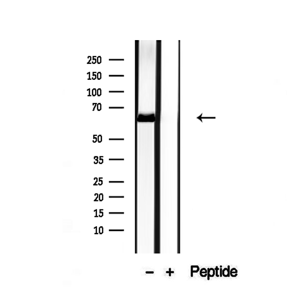 NR1D1 Antibody - Western blot analysis of extracts of MCF-7 cells using NR1D1 antibody.