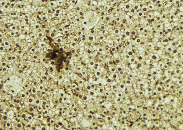 NR1D1 Antibody - 1:100 staining mouse liver tissue by IHC-P. The sample was formaldehyde fixed and a heat mediated antigen retrieval step in citrate buffer was performed. The sample was then blocked and incubated with the antibody for 1.5 hours at 22°C. An HRP conjugated goat anti-rabbit antibody was used as the secondary.
