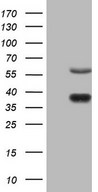 NR1D2 Antibody - HEK293T cells were transfected with the pCMV6-ENTRY control. (Left lane) or pCMV6-ENTRY NR1D2. (Right lane) cDNA for 48 hrs and lysed. Equivalent amounts of cell lysates. (5 ug per lane) were separated by SDS-PAGE and immunoblotted with anti-NR1D2.