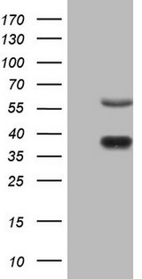NR1D2 Antibody - HEK293T cells were transfected with the pCMV6-ENTRY control (Left lane) or pCMV6-ENTRY NR1D2 (Right lane) cDNA for 48 hrs and lysed. Equivalent amounts of cell lysates (5 ug per lane) were separated by SDS-PAGE and immunoblotted with anti-NR1D2.