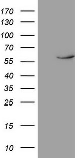 NR1D2 Antibody - HEK293T cells were transfected with the pCMV6-ENTRY control. (Left lane) or pCMV6-ENTRY NR1D2. (Right lane) cDNA for 48 hrs and lysed. Equivalent amounts of cell lysates. (5 ug per lane) were separated by SDS-PAGE and immunoblotted with anti-NR1D2.