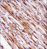 NR1D2 Antibody - NR1D2 Antibody immunohistochemistry of formalin-fixed and paraffin-embedded human heart tissue followed by peroxidase-conjugated secondary antibody and DAB staining.