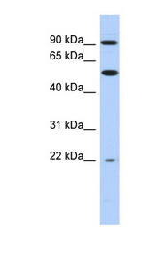 NR1D2 Antibody - NR1D2 antibody Western blot of THP-1 cell lysate. This image was taken for the unconjugated form of this product. Other forms have not been tested.