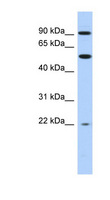 NR1D2 Antibody - NR1D2 antibody Western blot of THP-1 cell lysate. This image was taken for the unconjugated form of this product. Other forms have not been tested.
