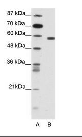 NR1D2 Antibody - A: Marker, B: Jurkat Cell Lysate.  This image was taken for the unconjugated form of this product. Other forms have not been tested.