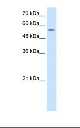 NR1H2 / LXR Beta Antibody - HepG2 cell lysate. Antibody concentration: 1.25 ug/ml. Gel concentration: 12%.  This image was taken for the unconjugated form of this product. Other forms have not been tested.