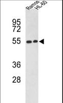 NR1H2 / LXR Beta Antibody - Western blot of NR1H2 Antibody in Ramos, HL-60 cell line lysates (35 ug/lane). NR1H2 (arrow) was detected using the purified antibody.