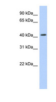 NR1H2 / LXR Beta Antibody - NR1H2 antibody Western blot of Transfected 293T cell lysate. This image was taken for the unconjugated form of this product. Other forms have not been tested.