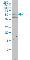 NR1H2 / LXR Beta Antibody - NR1H2 monoclonal antibody (M01), clone 2H2-H3 Western Blot analysis of NR1H2 expression in LNCaP.