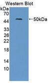 NR1H2 / LXR Beta Antibody - Western Blot; Sample: Recombinant protein.